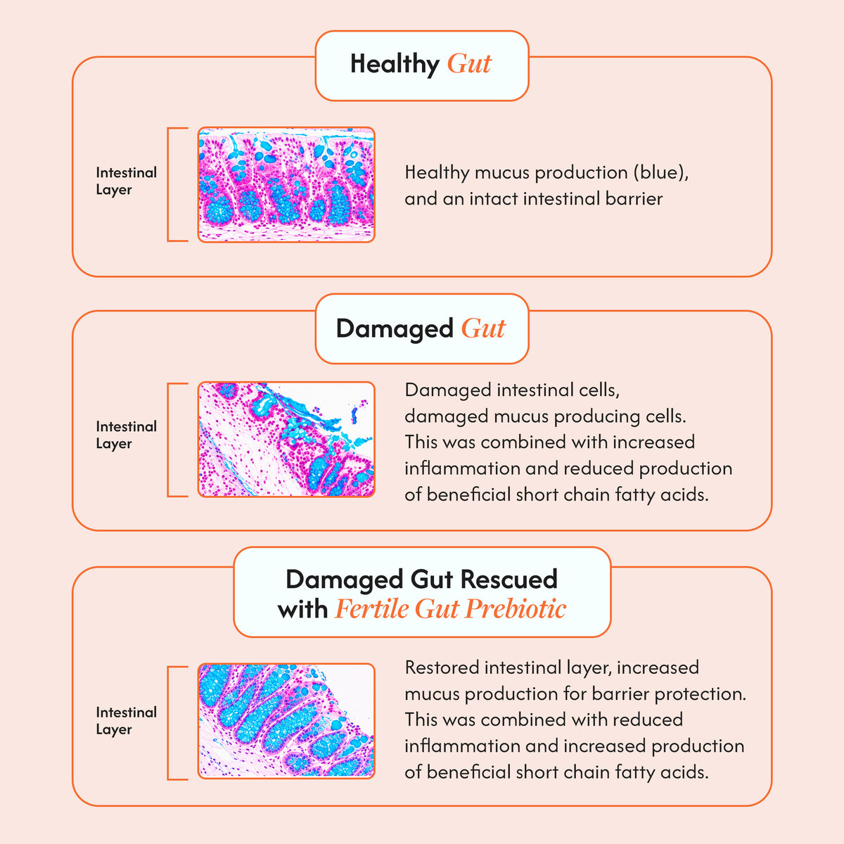 Microbiome Essentials Value Pack