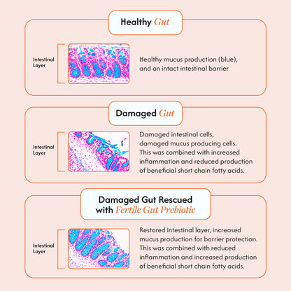 Microbiome Essentials Value Pack