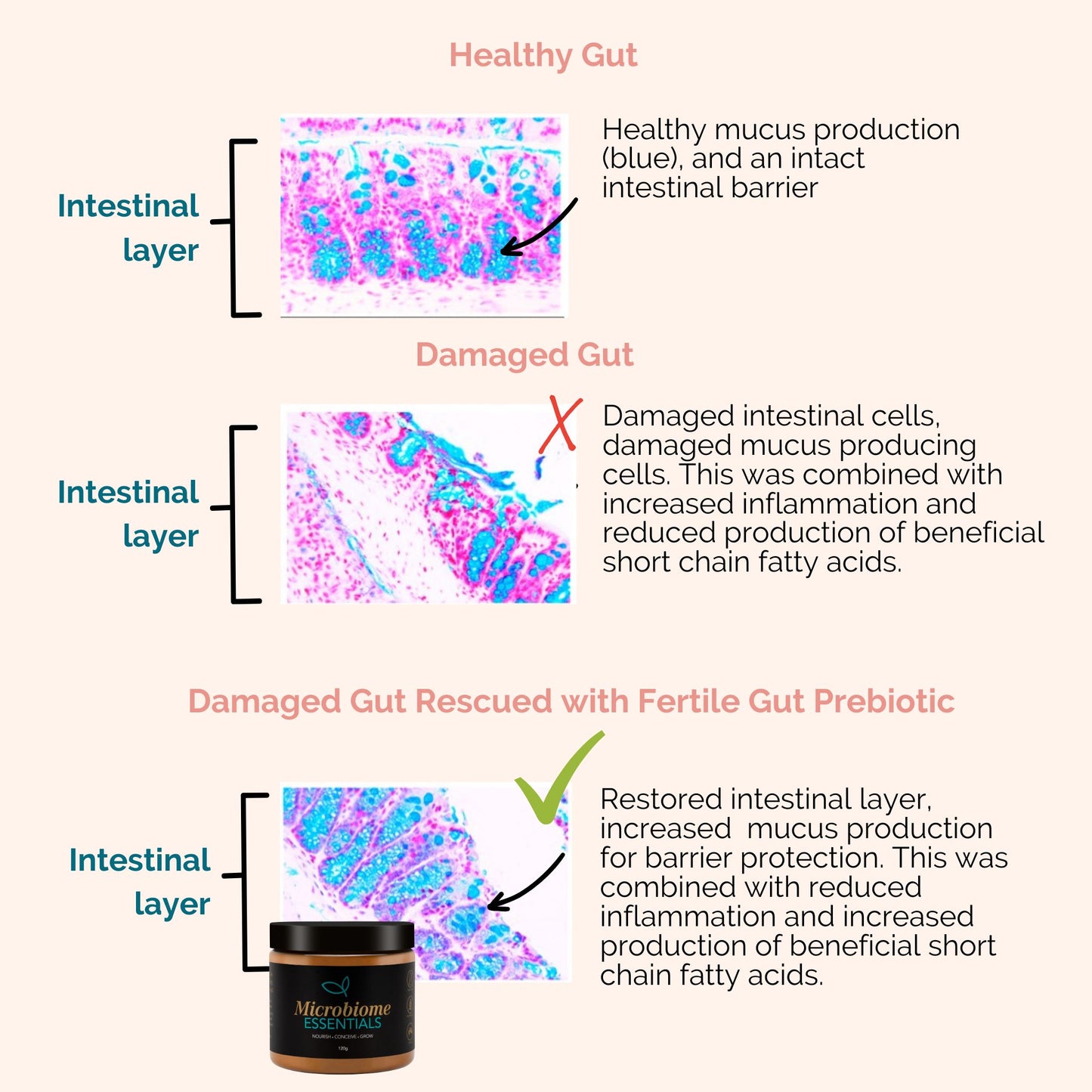 Microbiome Essentials